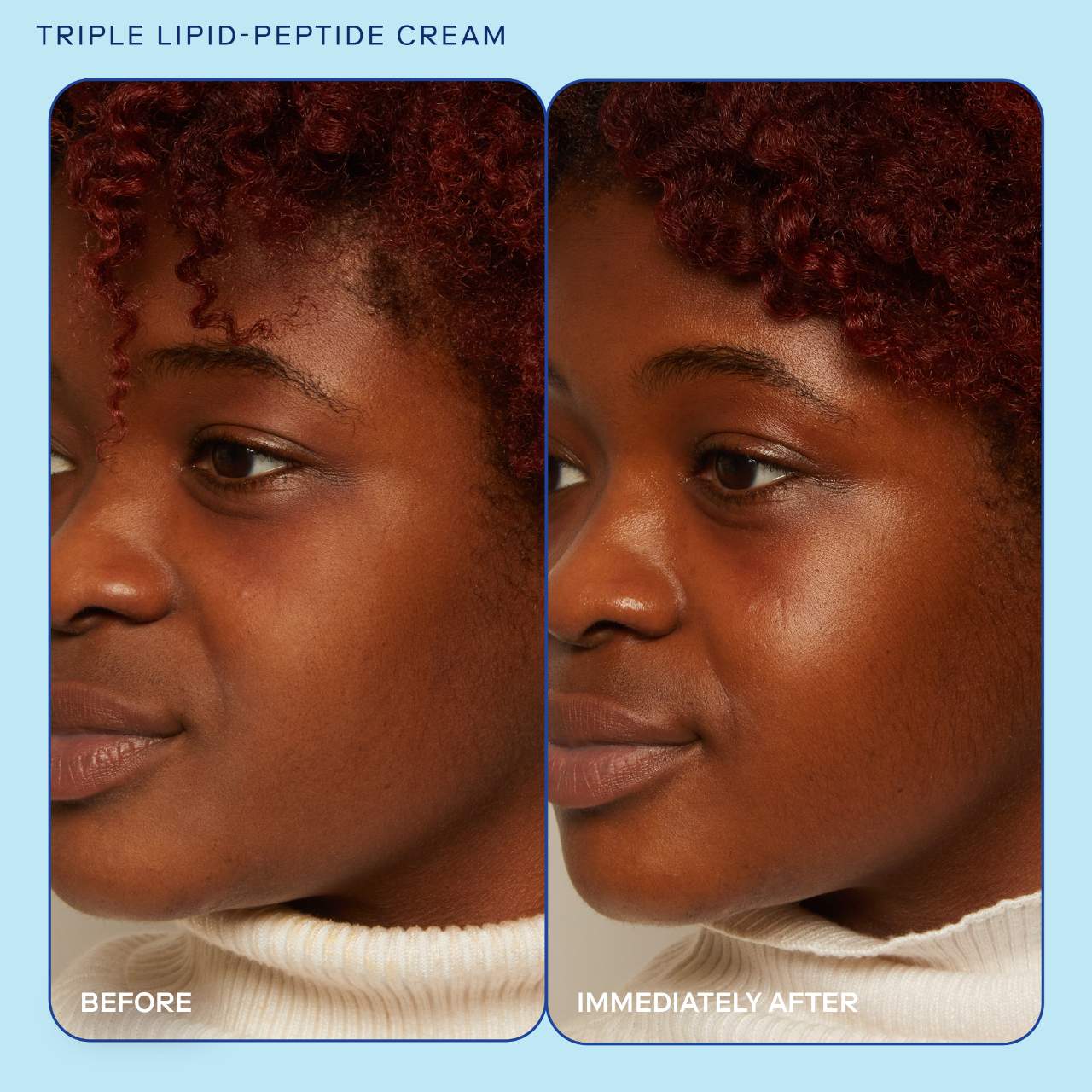 Crema hidratante y Reparadora Skinfix