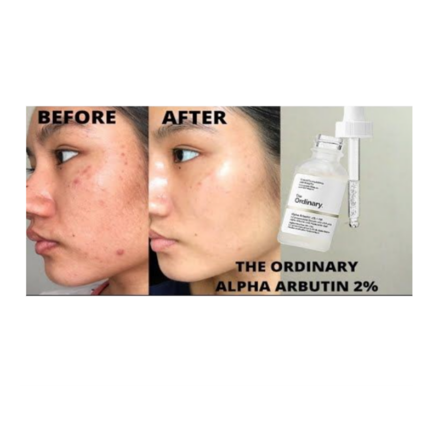 Alpha Arbutin 2% HA The Ordinary